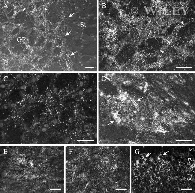 Connexin 26 Antibody in Immunohistochemistry (IHC)