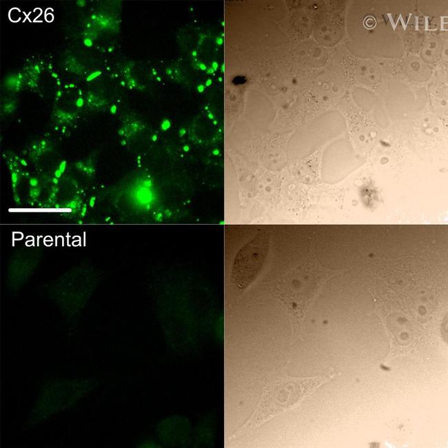 Connexin 26 Antibody in Immunocytochemistry (ICC/IF)