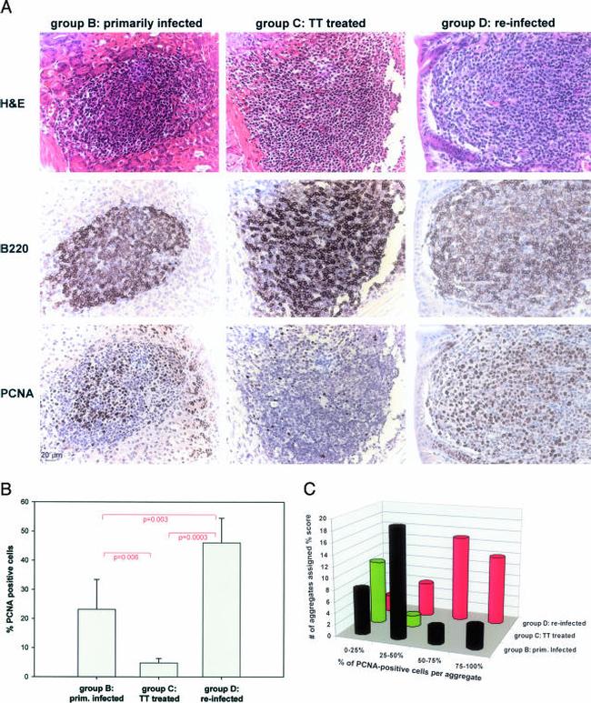 PCNA Antibody in Immunohistochemistry (Paraffin) (IHC (P))