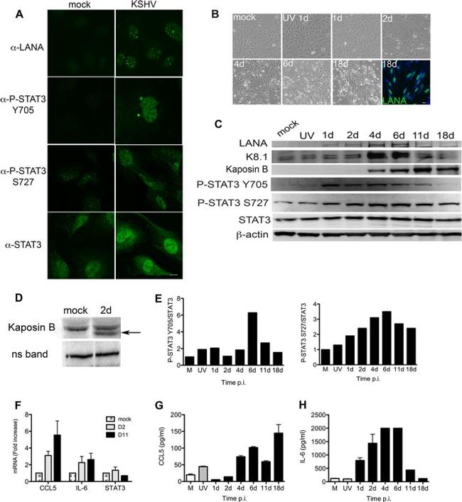 IL-6 Antibody in ELISA (ELISA)