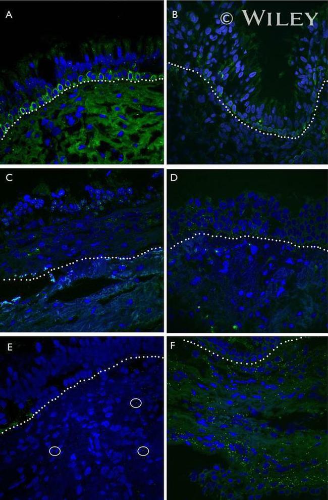 Connexin 26 Antibody in Immunohistochemistry (IHC)