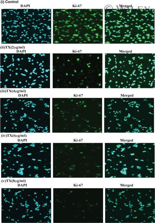 Ki-67 Antibody in Immunocytochemistry (ICC/IF)