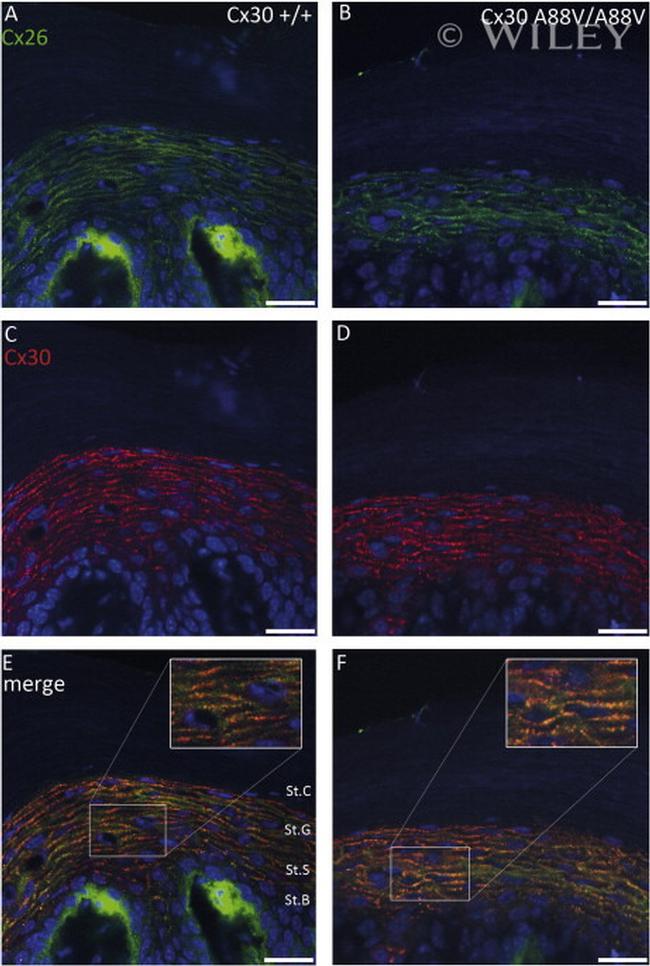 Connexin 26 Antibody in Immunocytochemistry (ICC/IF)