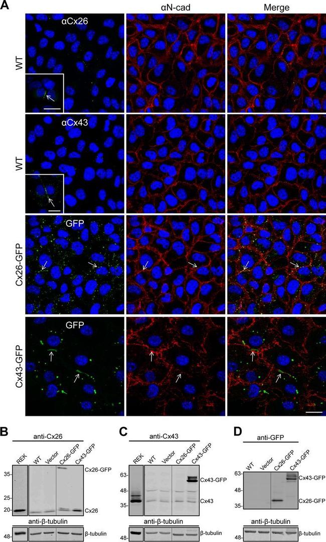 Connexin 26 Antibody in Immunocytochemistry (ICC/IF)