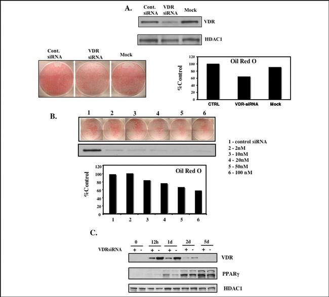 VDR Antibody in Western Blot (WB)