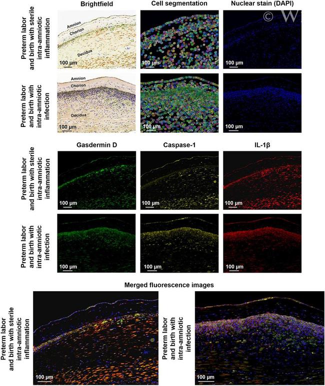 Caspase 1 Antibody in Immunohistochemistry (IHC)