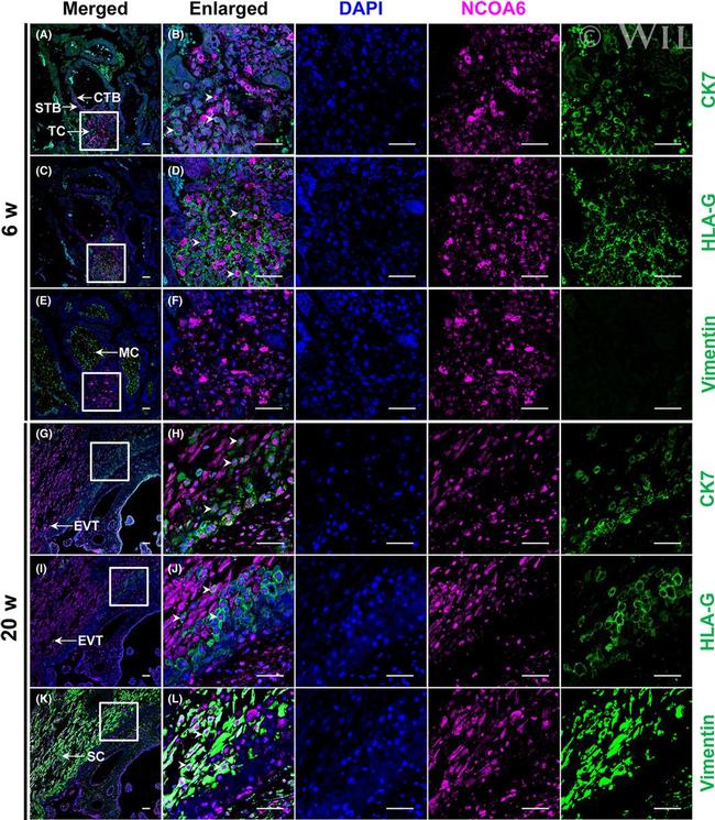 Vimentin Antibody in Immunohistochemistry (IHC)