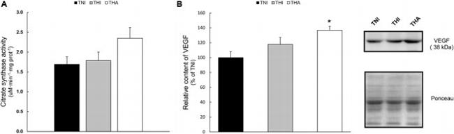 VEGF Antibody in Western Blot (WB)