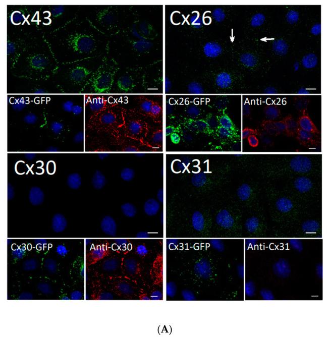 Connexin 26 Antibody in Immunocytochemistry (ICC/IF)