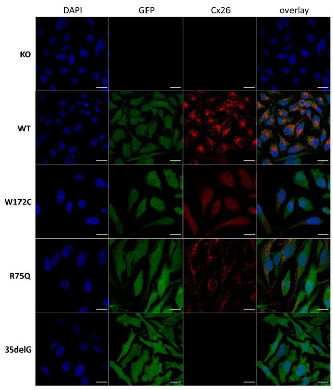 Connexin 26 Antibody in Immunocytochemistry (ICC/IF)