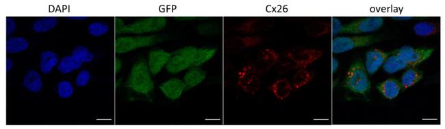 Connexin 26 Antibody in Immunocytochemistry (ICC/IF)