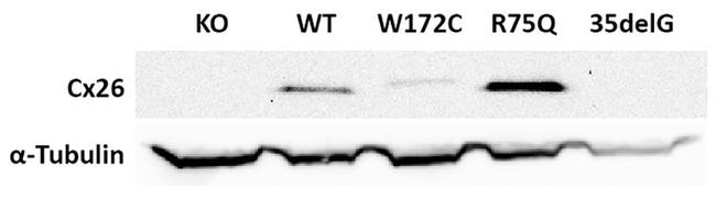 Connexin 26 Antibody in Western Blot (WB)