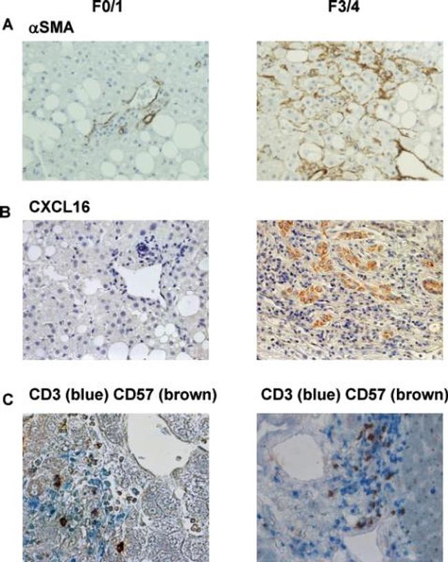 CD3 Antibody in Immunohistochemistry (IHC)