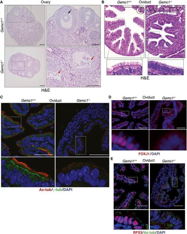 FOXJ1 Antibody in Immunohistochemistry (IHC)