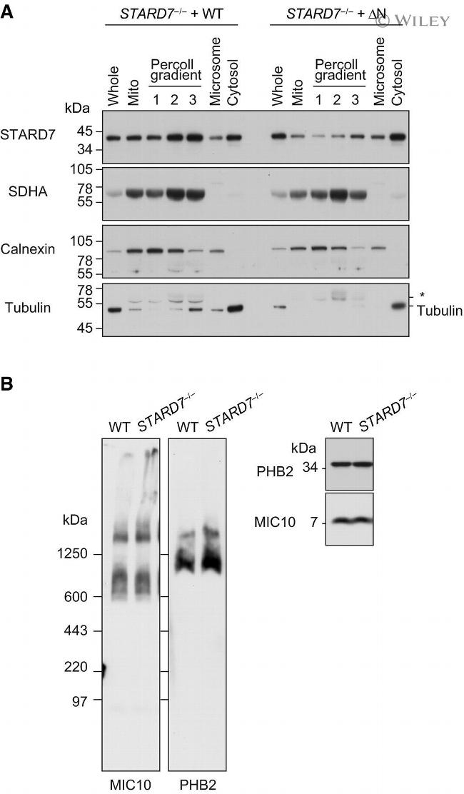 SDHA Antibody in Western Blot (WB)