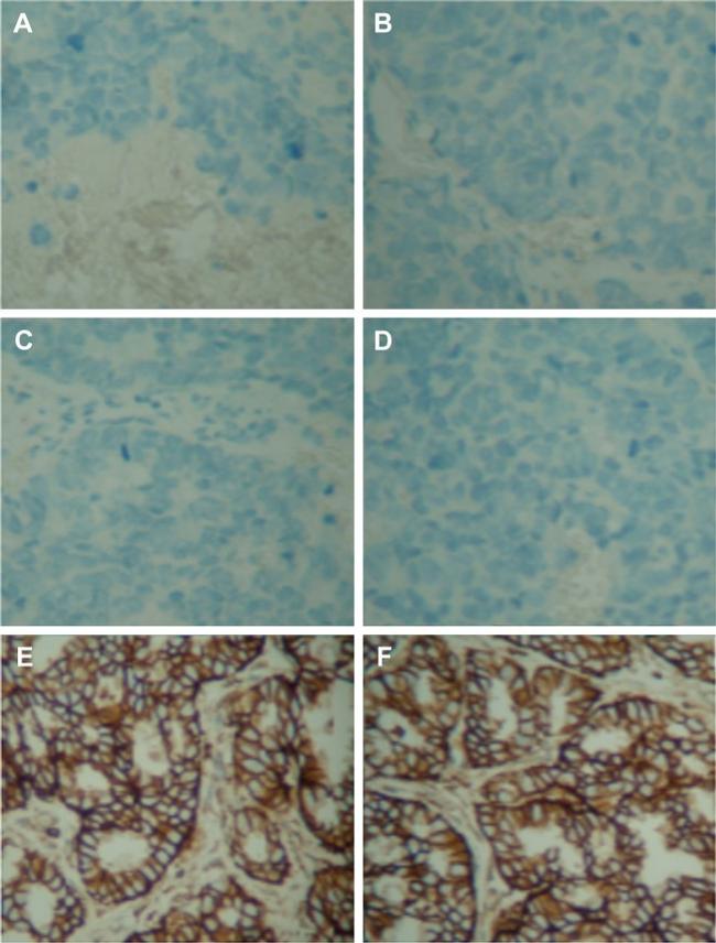 CD44 Antibody in Immunohistochemistry (IHC)