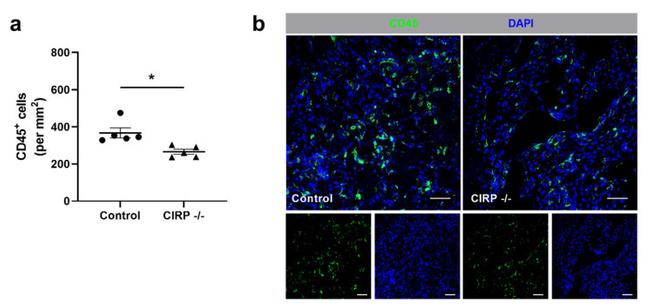 CD45 Antibody in Immunohistochemistry (IHC)