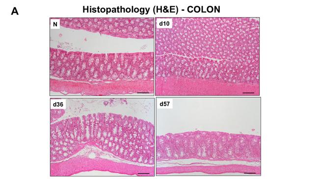 CD45R (B220) Antibody in Immunohistochemistry (IHC)