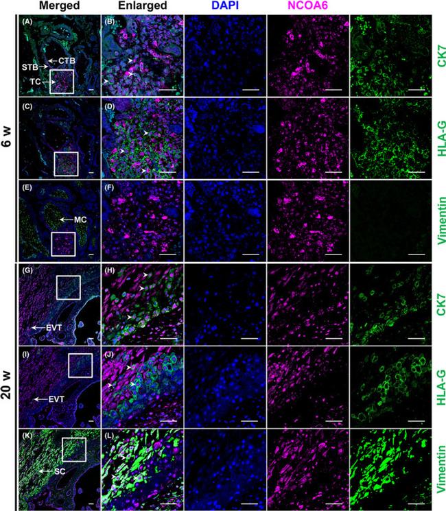 Vimentin Antibody in Immunocytochemistry (ICC/IF)