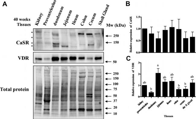 VDR Antibody in Western Blot (WB)