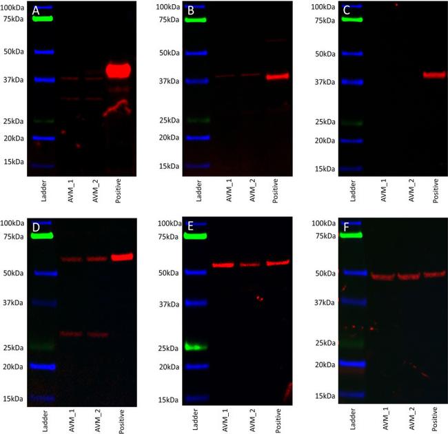 alpha Tubulin Antibody in Western Blot (WB)