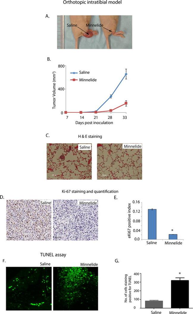 Ki-67 Antibody