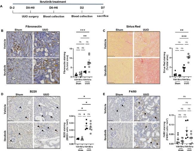 CD45R (B220) Antibody in Immunohistochemistry (IHC)