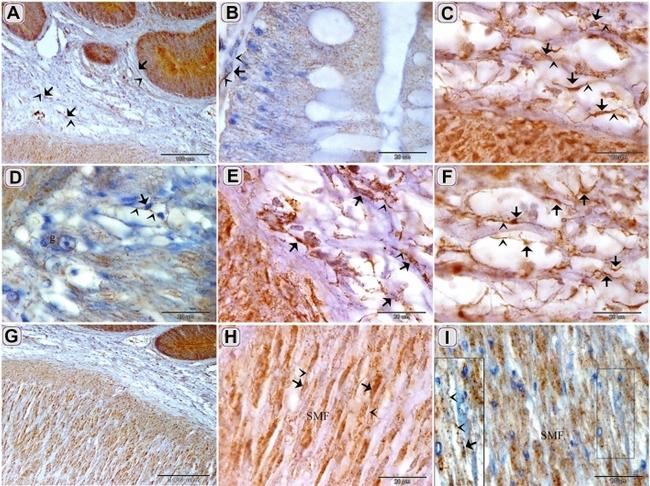 CD117 (c-Kit) Antibody in Immunohistochemistry (IHC)