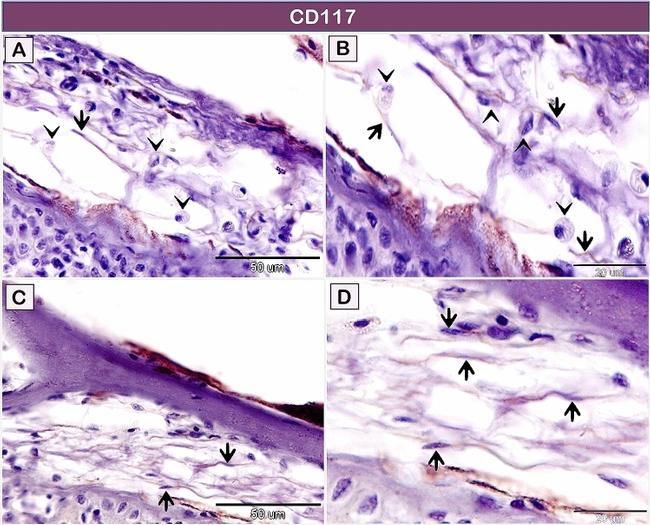 CD117 (c-Kit) Antibody in Immunohistochemistry (IHC)