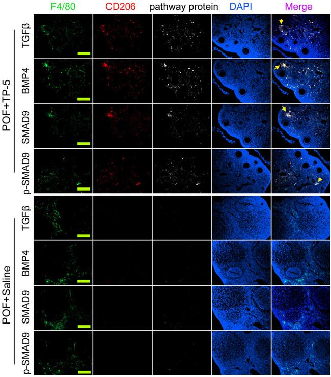 F4/80 Antibody in Immunocytochemistry (ICC/IF)