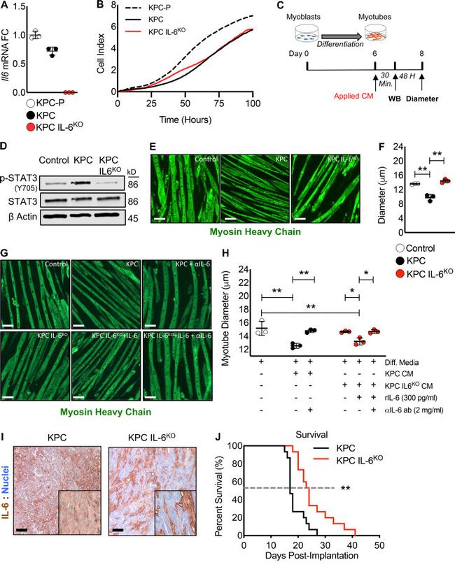 IL-6 Antibody in Neutralization (Neu)