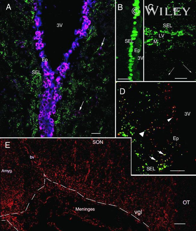 Connexin 26 Antibody in Immunohistochemistry (IHC)