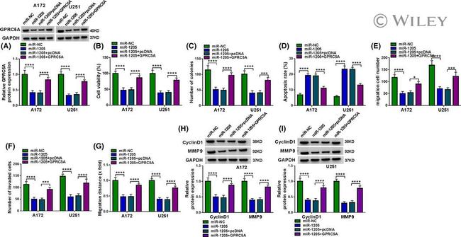 Cyclin D1 Antibody in Western Blot (WB)