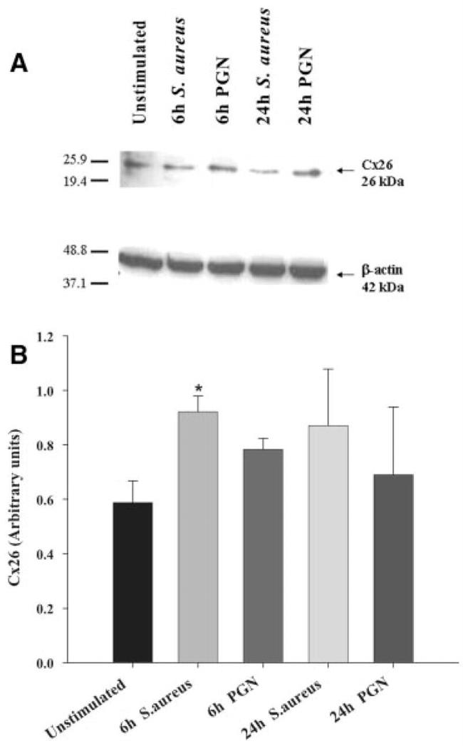 Connexin 26 Antibody in Western Blot (WB)