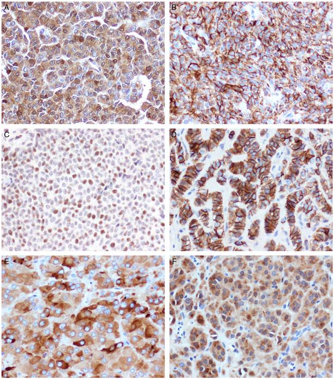 SMAD3 Antibody in Immunohistochemistry (Paraffin) (IHC (P))