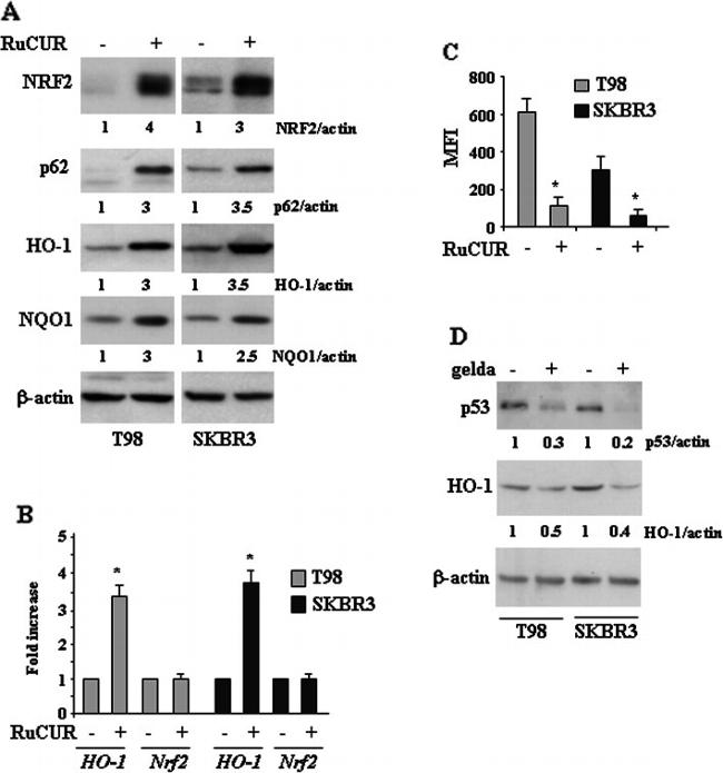 NQO1 Antibody in Western Blot (WB)