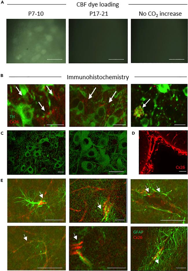 Connexin 26 Antibody in Immunocytochemistry (ICC/IF)