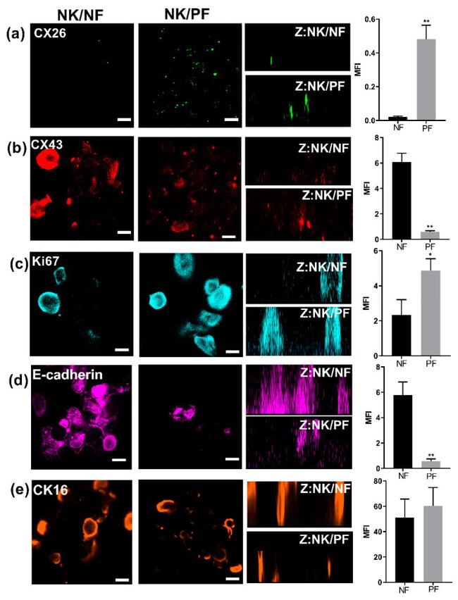 Connexin 26 Antibody in Immunohistochemistry (IHC)