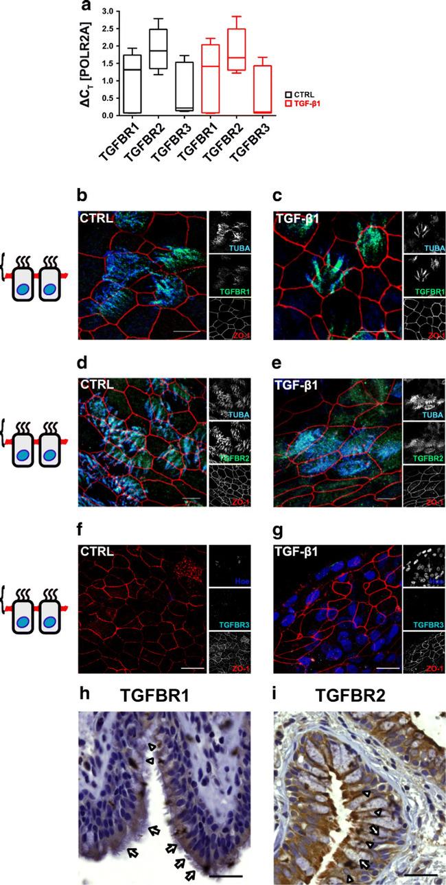 alpha Tubulin Antibody in Immunocytochemistry (ICC/IF)