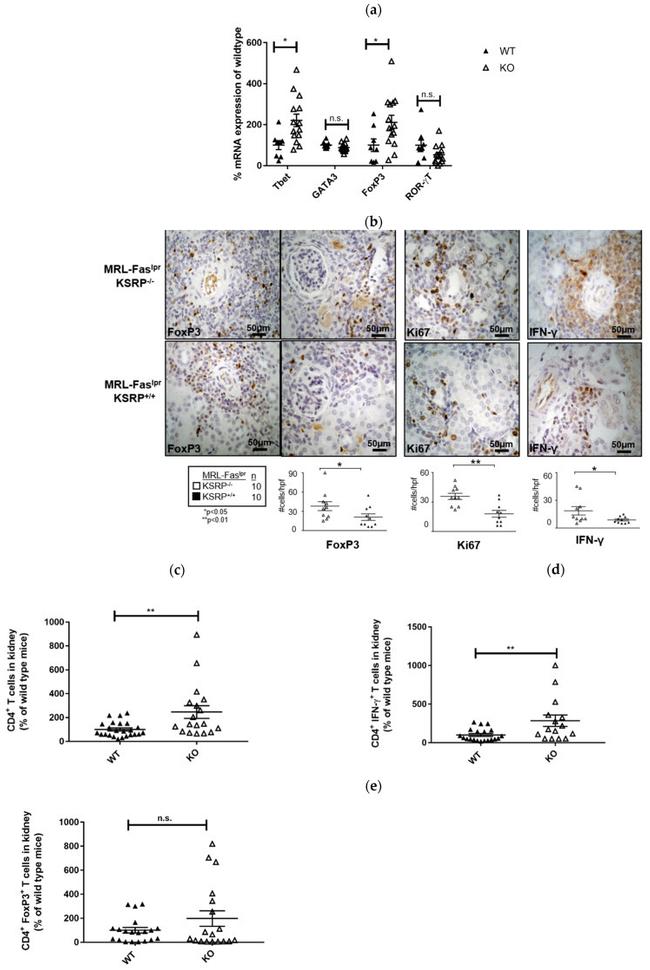 IFN gamma Antibody in Immunohistochemistry (IHC)