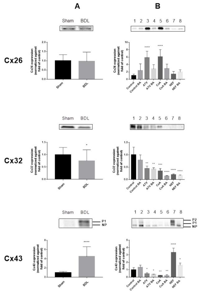 Connexin 26 Antibody in Western Blot (WB)