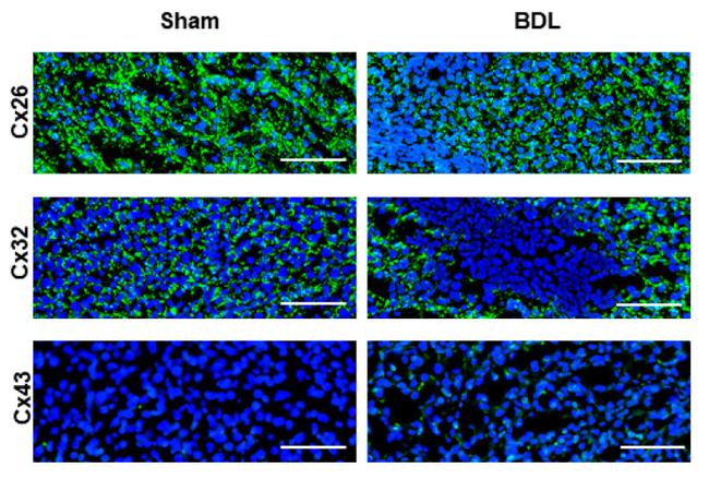 Connexin 26 Antibody in Immunohistochemistry (IHC)