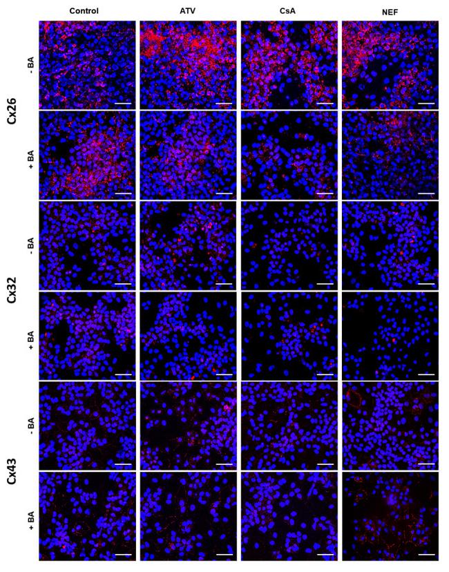 Connexin 26 Antibody in Immunocytochemistry (ICC/IF)