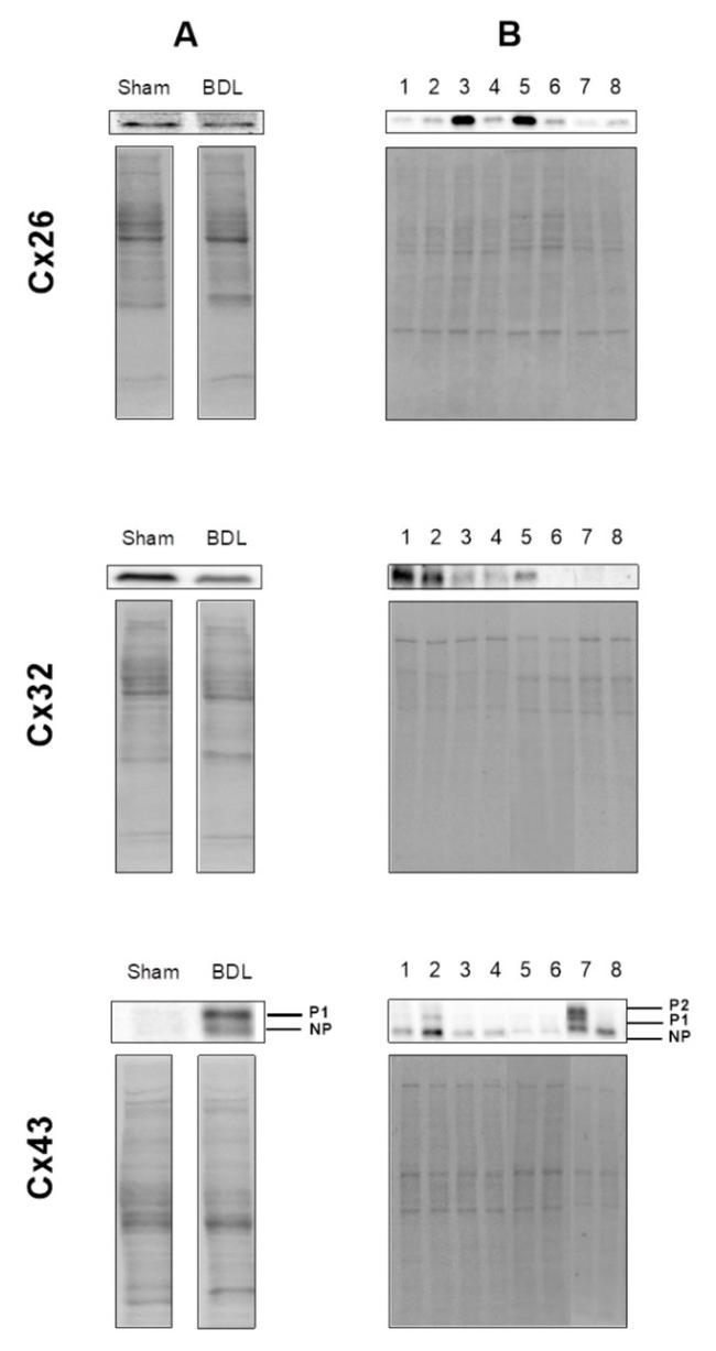 Connexin 26 Antibody in Western Blot (WB)