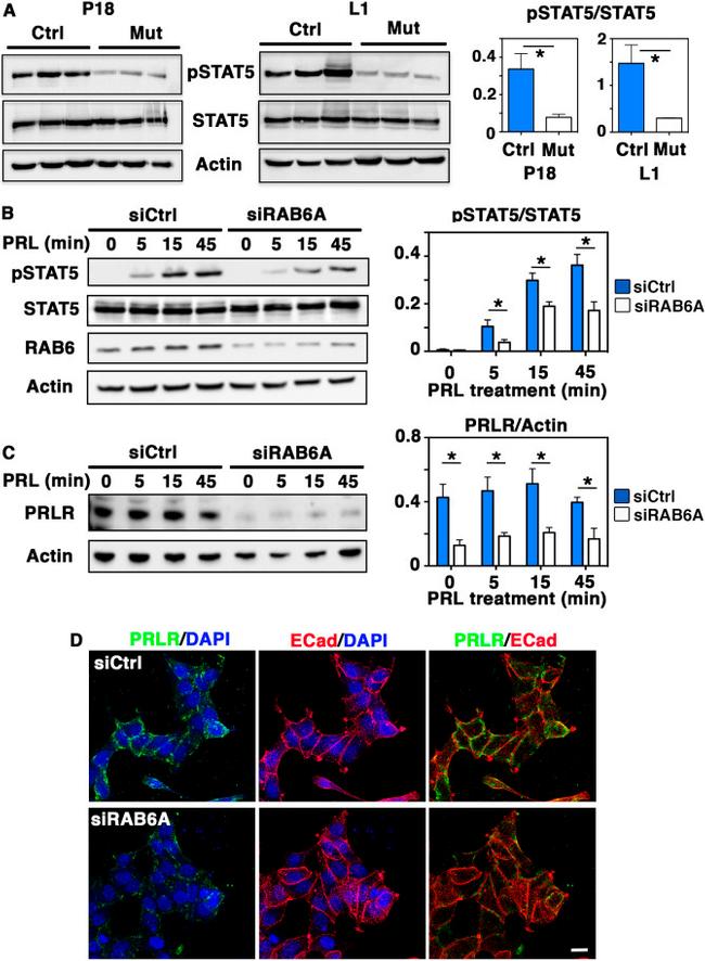 Prolactin Receptor Antibody in Western Blot, Immunocytochemistry (WB, ICC/IF)