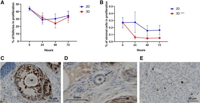 Ki-67 Antibody in Immunohistochemistry (IHC)