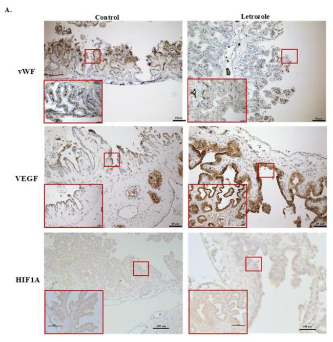 HIF1A Antibody in Immunohistochemistry (IHC)