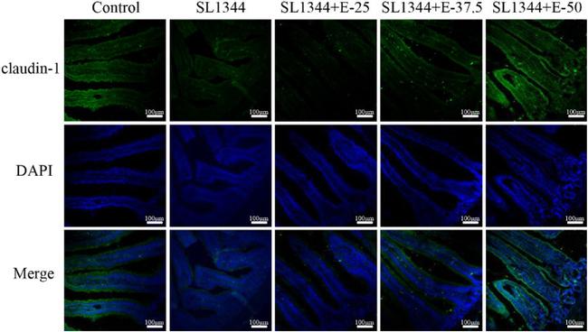 Claudin 1 Antibody in Immunohistochemistry (IHC)