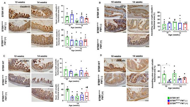 Occludin Antibody in Immunohistochemistry (IHC)