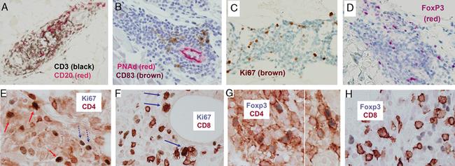 FOXP3 Antibody in Immunohistochemistry (IHC)